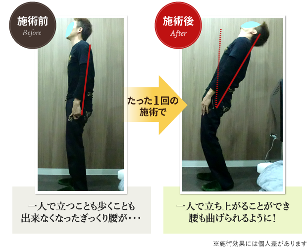 施術前と施術後の比較